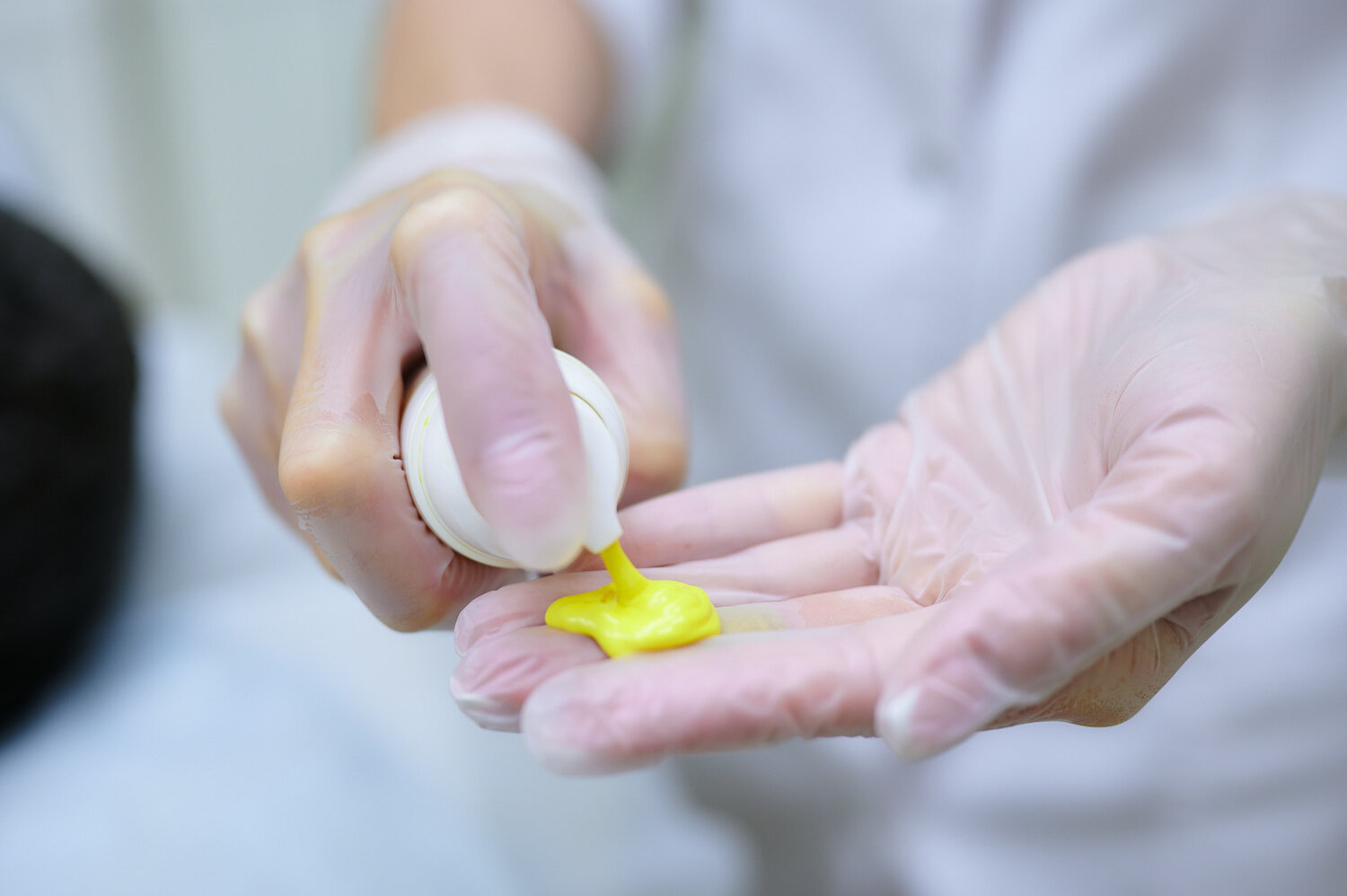 Химический пилинг