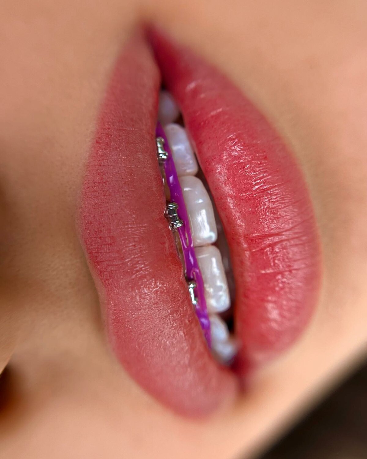 Коррекция татуажа