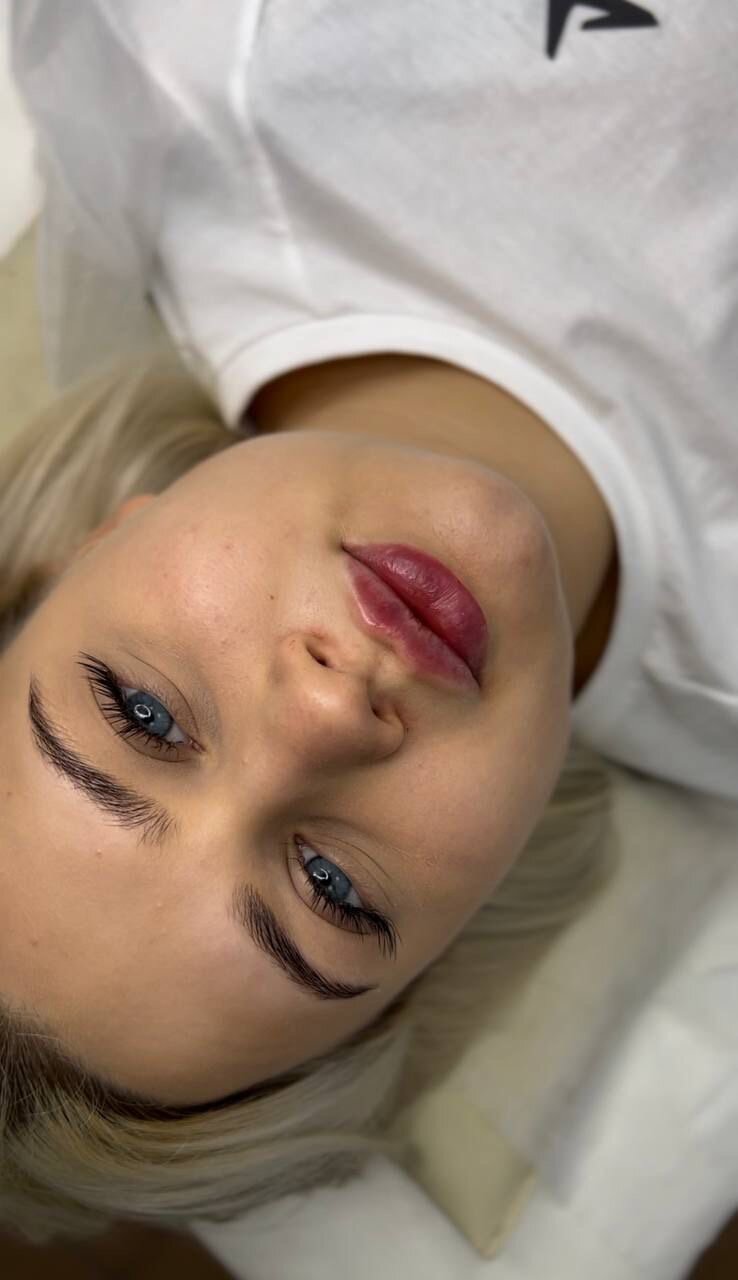 Увеличение губ