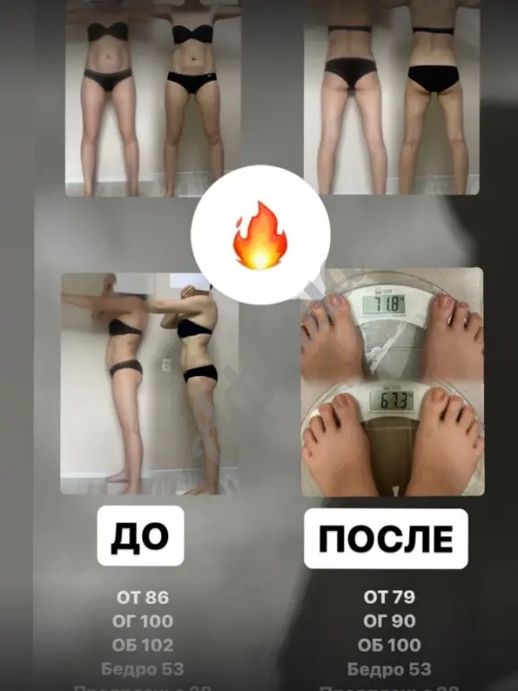 Личное сопровождение нутрициолога